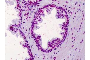 Human Prostate: Formalin-Fixed, Paraffin-Embedded (FFPE) (Aryl Hydrocarbon Receptor antibody  (N-Term))