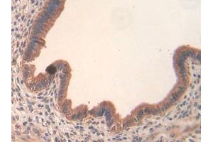 Detection of Slit3 in Mouse Uterus Tissue using Polyclonal Antibody to Slit Homolog 3 (Slit3) (SLIT3 antibody  (AA 1348-1517))