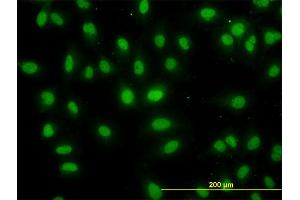 Immunofluorescence of monoclonal antibody to DDX56 on HeLa cell. (DDX56 antibody  (AA 450-547))