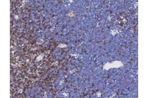 IHC analysis of TCR alpha/TRAC using anti-TCR alpha/TRAC antibody (ABIN6719654). (TRAC antibody  (AA 1-114))
