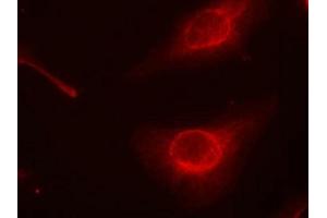 Immunofluorescence staining of methanol-fixed Hela cells using cofilin(Phospho-Ser3) Antibody. (Cofilin antibody  (pSer3))
