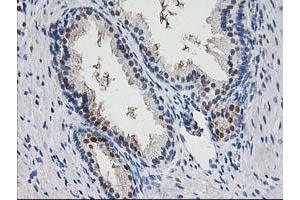 Immunohistochemical staining of paraffin-embedded Human prostate tissue using anti-PNMT mouse monoclonal antibody. (PNMT antibody)