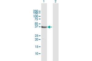 Western Blot analysis of EPM2A expression in transfected 293T cell line by EPM2A MaxPab polyclonal antibody. (EPM2A antibody  (AA 1-331))