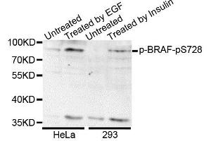 Western blot analysis of extracts of various cell lines, using Phospho-BRAF-S728 antibody. (BRAF antibody  (pSer728))