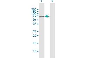 Western Blot analysis of PARP3 expression in transfected 293T cell line by PARP3 MaxPab polyclonal antibody. (PARP3 antibody  (AA 1-533))