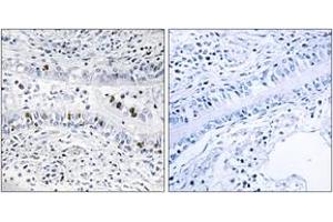 Immunohistochemistry (IHC) image for anti-Enhancer of Zeste Homolog 1 (EZH1) (AA 171-220) antibody (ABIN1534043)