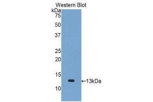 Western Blotting (WB) image for anti-Chemokine (C-C Motif) Ligand 2 (CCL2) (AA 24-125) antibody (ABIN1859783) (CCL2 antibody  (AA 24-125))