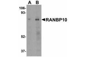 Image no. 1 for anti-RAN Binding Protein 10 (RANBP10) (Internal Region) antibody (ABIN478260) (RANBP10 antibody  (Internal Region))