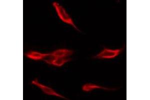 Immunofluorescence (fixed cells) (IF/ICC) image for anti-Insulin Receptor Substrate 1 (IRS1) (pSer312) antibody (ABIN6256264)