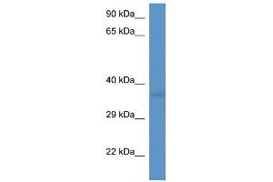 Western Blot showing CD34 antibody used at a concentration of 1 ug/ml against Fetal Heart Lysate (CD34 antibody  (C-Term))
