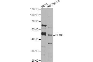 Western blot analysis of extracts of various cell lines, using BLMH Antibody (ABIN2561425) at 1:1000 dilution. (BLMH antibody)