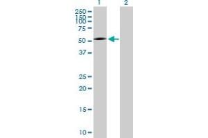 Western Blot analysis of P2RX5 expression in transfected 293T cell line by P2RX5 MaxPab polyclonal antibody. (P2RX5 antibody  (AA 1-422))