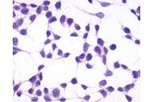 Anti-GPR4 antibody immunocytochemistry (ICC) staining of untransfected HEK293 human embryonic kidney cells. (GPR4 antibody  (C-Term))