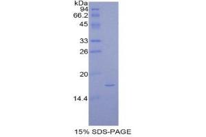 SDS-PAGE (SDS) image for Pleiotrophin (PTN) (AA 33-168) protein (His tag) (ABIN1877733)