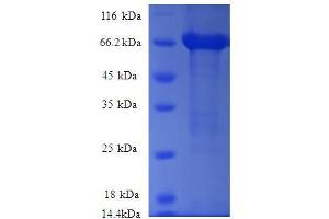 ARHGEF18 Protein (AA 159-551, partial) (GST tag)