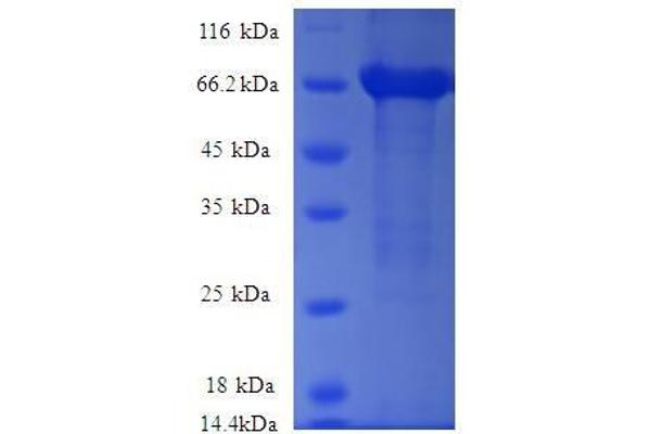 ARHGEF18 Protein (AA 159-551, partial) (GST tag)