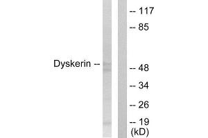 Western Blotting (WB) image for anti-Dyskeratosis Congenita 1, Dyskerin (DKC1) (Internal Region) antibody (ABIN1849014)