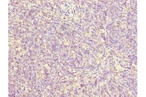 Immunohistochemistry of paraffin-embedded human thymus tissue using ABIN7176109 at dilution of 1:100 (ZNF131 antibody  (AA 80-379))