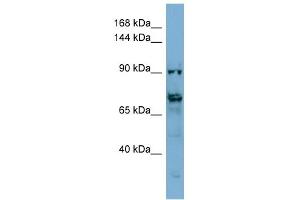 WB Suggested Anti-TMEM146 Antibody Titration: 0. (TMEM146 antibody  (Middle Region))