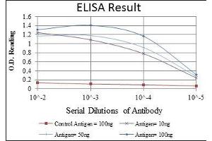 Red: Control Antigen (100 ng), Purple: Antigen (10 ng), Green: Antigen (50 ng), Blue: Antigen (100 ng), (CCT2 antibody)