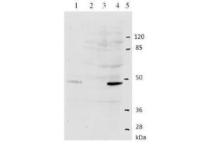 anti-Human Papilloma Virus Type 11 (HPV-11) (AA 202-284) antibody