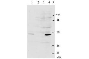 Western Blotting (WB) image for anti-Human Papilloma Virus Type 11 (HPV-11) (AA 202-284) antibody (ABIN781775) (Human Papilloma Virus Type 11 (HPV-11) (AA 202-284) antibody)