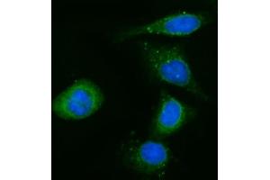 IF analysis of CYB5R3 using anti-CYB5R3 antibody (ABIN7600822).