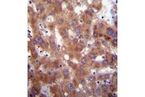 Immunohistochemistry analysis in formalin fixed and paraffin embedded human liver tissue reacted with 17-beta-HSD4 / HSD17B4 Antibody (Center) followed which was peroxidase conjugated to the secondary antibody and followed by DAB staining. (HSD17B4 antibody  (Middle Region))