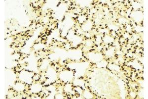 ABIN6279147 at 1/100 staining Mouse lung tissue by IHC-P. (ATXN7 antibody  (Internal Region))