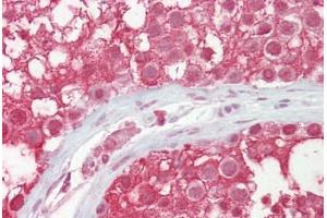 Anti-CUL3 / Cullin 3 antibody IHC staining of human testis. (Cullin 3 antibody  (AA 618-667))