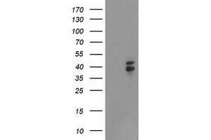 Western Blotting (WB) image for anti-NudE Nuclear Distribution E Homolog (A. Nidulans)-Like 1 (NDEL1) antibody (ABIN1499853)