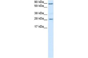 WB Suggested Anti-BCL2 Antibody Titration:  0. (Bcl-2 antibody  (N-Term))