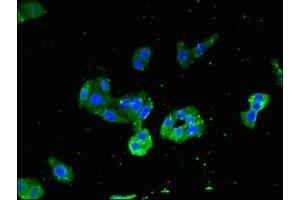 Immunofluorescent analysis of HepG2 cells using ABIN7160472 at dilution of 1:100 and Alexa Fluor 488-congugated AffiniPure Goat Anti-Rabbit IgG(H+L) (MYD88 antibody  (AA 1-282))