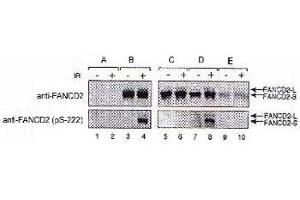FA-D2 fibroblasts were stably transfected with either pMMP (empty vector, A), FANCD2 (wt, B), FANCD2 (S222A, C), FANCD2 (triple mutant, D), or FANCD2 (quadruple mutant, E).