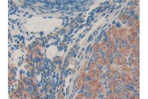 DAB staining on IHC-P; Samples: Mouse Ovary Tissue (MTA1 antibody  (AA 6-218))