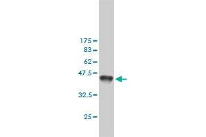 Western Blot detection against Immunogen (36. (MSH6 antibody  (AA 931-1030))