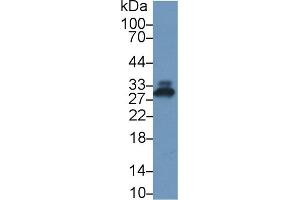 Detection of CRP in Rat Serum using Polyclonal Antibody to C Reactive Protein (CRP) (CRP antibody  (AA 20-225))