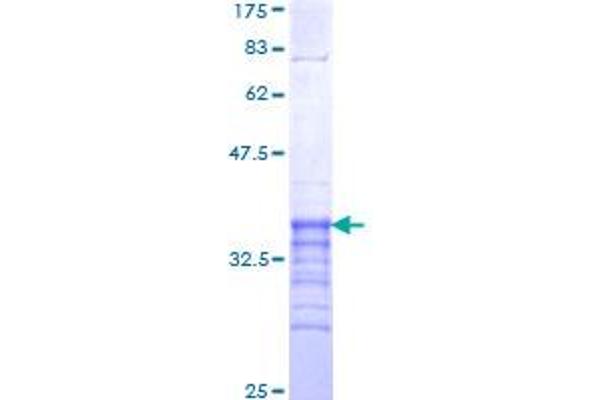 RFXAP Protein (AA 179-244) (GST tag)