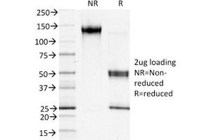 SDS-PAGE Analysis of Purified S100A4 Mouse Monoclonal Antibody ABIN6383823. (s100a4 antibody)