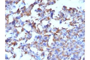 Formalin-fixed, paraffin-embedded human Histiocytoma stained with CD163-Monospecific Mouse Monoclonal Antibody (M130/2162). (CD163 antibody  (AA 43-196))