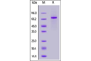 Human NOTCH3, Fc Tag on  under reducing (R) condition. (NOTCH3 Protein (AA 40-467) (Fc Tag))