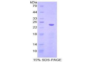 SDS-PAGE (SDS) image for Cadherin 5 (CDH5) (AA 251-426) protein (His tag) (ABIN2124203)