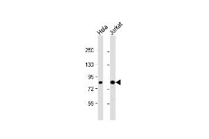 All lanes : Anti-CHUK Antibody (C-term) at 1:1000 dilution Lane 1: Hela whole cell lysate Lane 2: Jurkat whole cell lysate Lysates/proteins at 20 μg per lane. (IKK alpha antibody  (C-Term))