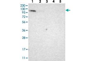 Western blot analysis of Lane 1: RT-4, Lane 2: U-251 MG, Lane 3: Human Plasma, Lane 4: Liver, Lane 5: Tonsil with LONP2 polyclonal antibody .