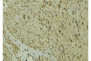 ABIN6277295 at 1/100 staining Mouse muscle tissue by IHC-P. (MEF2C antibody  (C-Term))