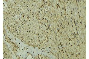 ABIN6277295 at 1/100 staining Mouse muscle tissue by IHC-P.