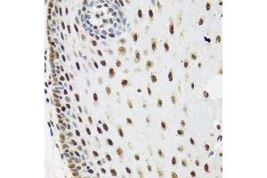 Immunohistochemistry of paraffin-embedded human esophagus using SKIV2L2 antibody. (MTR4 antibody  (AA 1-304))