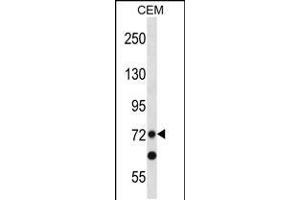 Western blot analysis in CEM cell line lysates (35ug/lane). (PRDM8 antibody  (N-Term))