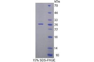 SDS-PAGE analysis of Human ZRF1 Protein. (DNAJC2 Protein)
