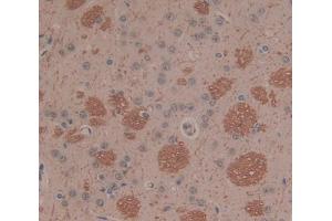 Used in DAB staining on fromalin fixed paraffin- embedded Kidney tissue (PLA2G2D antibody  (AA 20-134))
